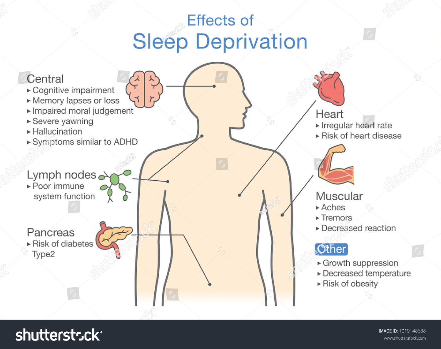 Effects of Sleep Diprivation