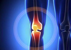 All about Knee Pain