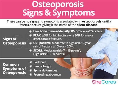 Osteoporosis: The Facts
