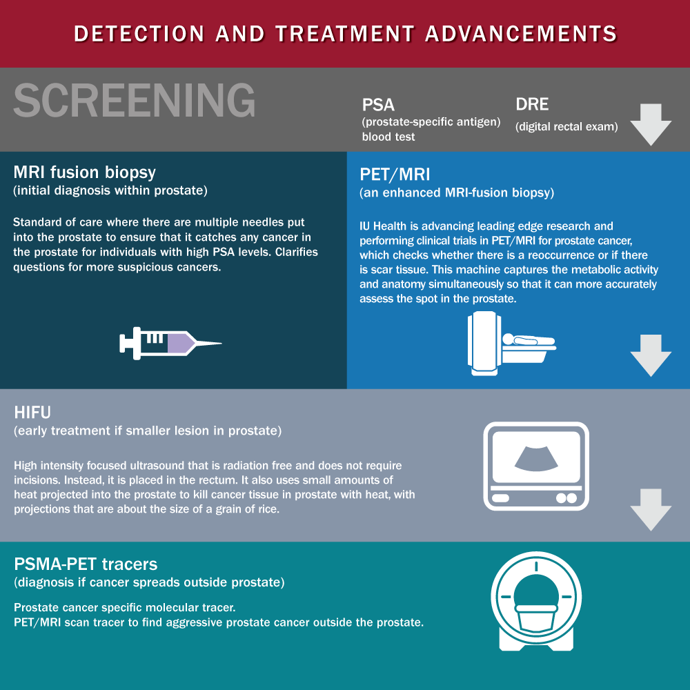 Prostate Cancer: the facts -Screening Diagnosis