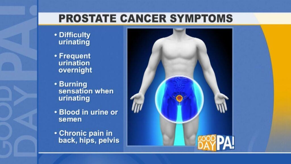 Prostate Cancer The Facts Universal Health Products 4935