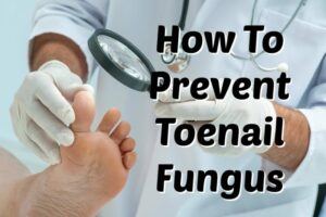 The Toenail fungus - Toenail Fungus Prevention