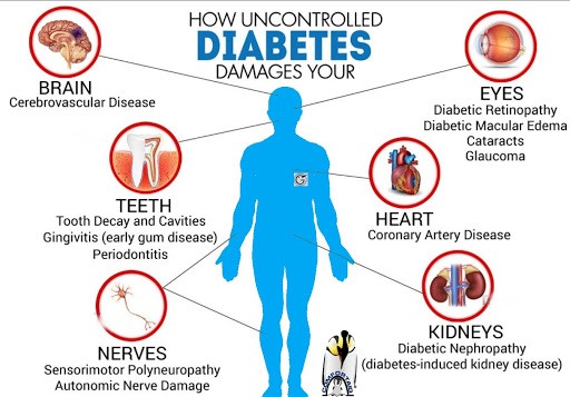 What is Diabetes About - Diabetes Complications