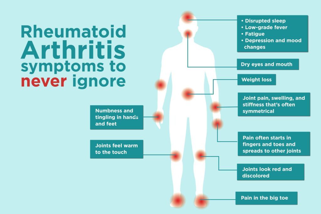 Info about Rheumatoid Arthritis - Arthritis Symptoms