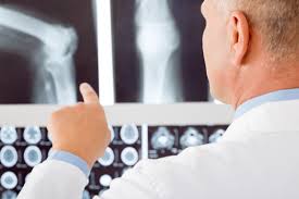 Info about Rheumatoid Arthritis - Treating Rheumatoid Arthritis 