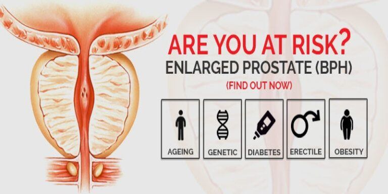 What is BPH About? | Universal Health Products